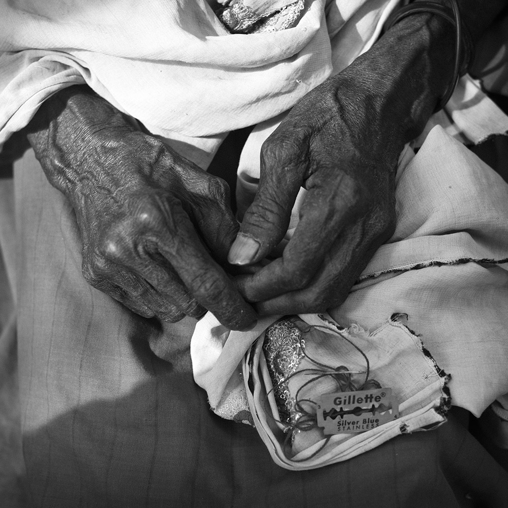 Mutilacion genital femenina Mutilacion genital femenina