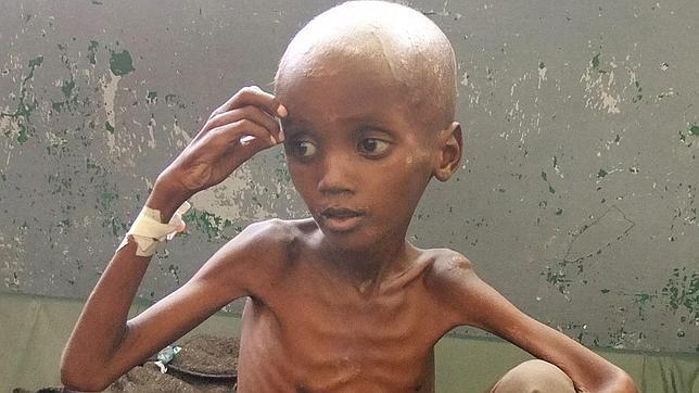 Hambre-Africa Hambre-Africa