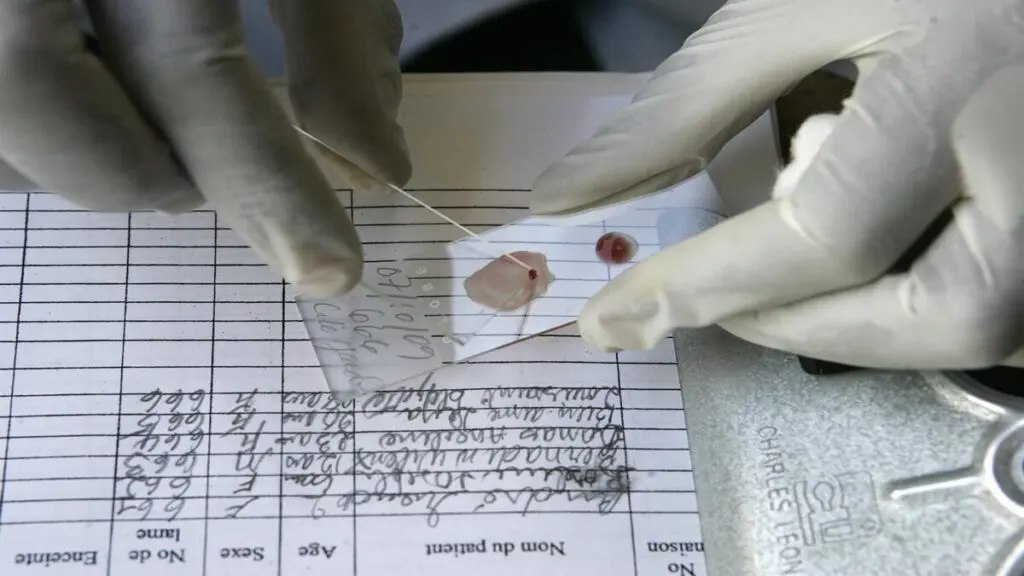 América en 2023: 342 personas murieron a causa de la malaria, según la OMS América en 2023: 342 personas murieron a causa de la malaria, según la OMS